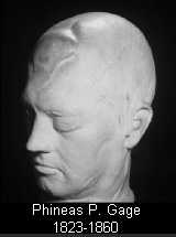 Phineas Gage Death Mask