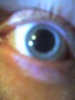 Eye bzp