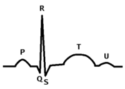 Systole QRS Complex