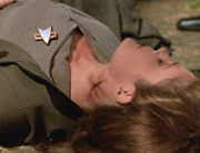 Janeway, neck burn