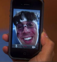 Tbbt howard injury